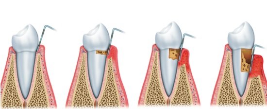 Implantologie - clinica stomatologie