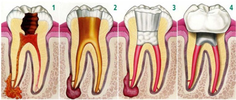 Implantologie - clinica stomatologie