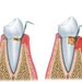 Implantologie - clinica stomatologie