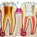 Implantologie - clinica stomatologie